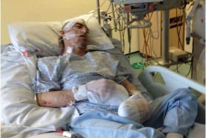 Ryan Penfold after life-saving brain surgery following a car accident.