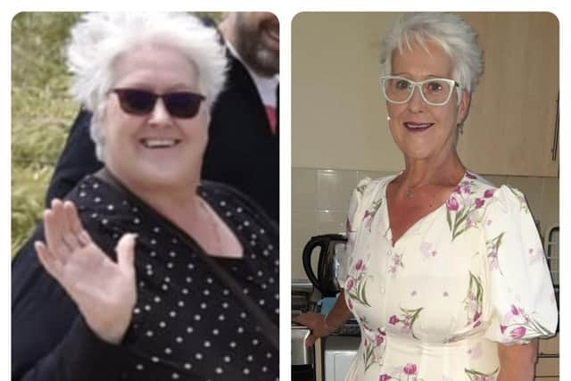 Lesley’s before and after her 10 stone weight loss