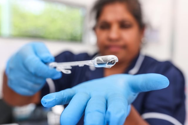 The BEST4 trial is testing a sponge on a string, released when the patient swallows a capsule, to improve screening for oesophageal cancer and Barrett's oesophagus.