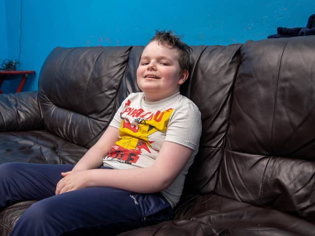 Alex Hoare has a very rare incurable genetic disease called Neurofibromatosis type 2

Pictured: Alex Hoare 10 at his home

Picture: Habibur Rahman