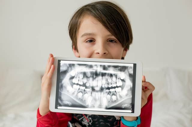 A child with an X-ray of his teeth given to him by the dentist.