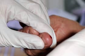 File photo of a person being tested for hepatitis C. 
Zak Hussein/PA Wire