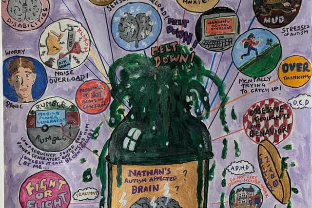 “Nathan Wong's Autism Affected brain”