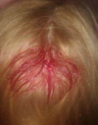 Gosport dad Ashley Parkes has launched an appeal after his daughter Lilly was hit in head with a BB gun pellet. Pic Ashley Parkes.