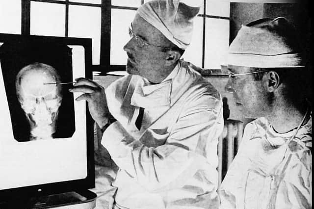 Dr. Walter Freeman, left, and Dr. James W. Watts study an X ray before a psychosurgical operation. Psychosurgery is cutting into the brain to form new patterns and rid a patient of delusions, obsessions, nervous tensions and the like. From the Saturday Evening Post, 24 May 1941, pages 18-19. Picture: Harris A Ewing