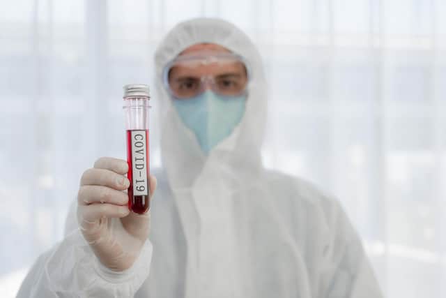 Coronavirus continues to spread around the globe. Picture: Shutterstock