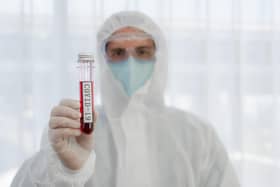Coronavirus continues to spread around the globe. Picture: Shutterstock