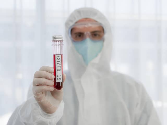 Coronavirus continues to spread around the globe. Picture: Shutterstock
