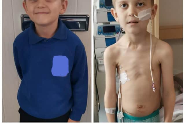 Jake Carson-Blake, 8, from Waterlooville has stage 4 Hodgkin's Lymphoma. Picture: Ali Carson-Blake
