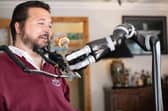 Military veteran Jon Noble from Havant, Hampshire has able to feed himself for the first time in 17 years in July, after receiving a robotic arm thanks to charity funding. Jon has become the first person with a spinal cord injury in the UK to receive a JACO assistive robotic arm. Picture: Andy Bate.