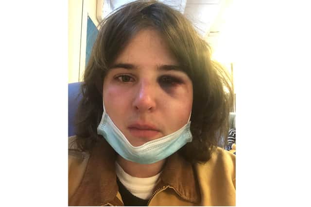Victim Danny Fletcher was forced to take two weeks off work, unpaid, to recover from the attack. on Saturday, October 20.