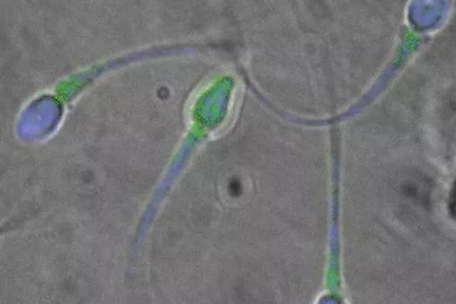 Could polluted water be leading to infertility problems?