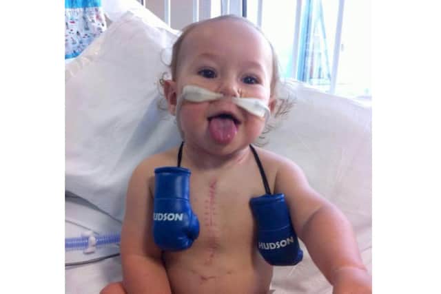 Andy Trevithick will be completing the distance of Everest by walking up and down his stairs. Andy's son Hudson Trevithick (now 6) has had 5 open heart surgeries.Pictured is: Hudson Trevithick.