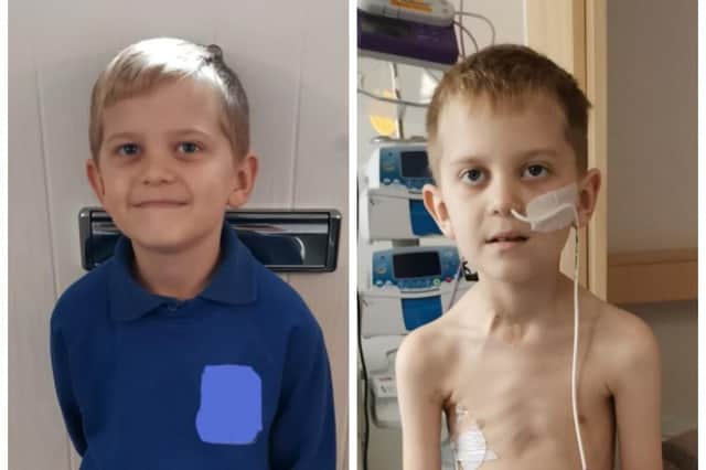 Jake Carson-Blake, 8, from Waterlooville has stage 4 Hodgkin lymphoma, before and after his diagnosis
Picture: Ali Carson-Blake