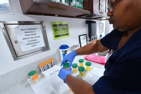 The rates of sexually transmitted illnesses per local authority have been released, including the data for Portsmouth.  Pictured is medical assistant Barbara Dupree, of the AIDS Healthcare Foundation (AHF) Wellness Centre, closing bottles of patient's urine submitted for testing in Hollywood, California. Picture: FREDERIC J. BROWN/AFP via Getty Images.