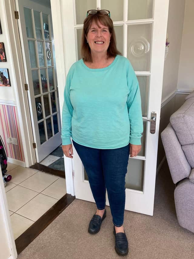 Before weight loss