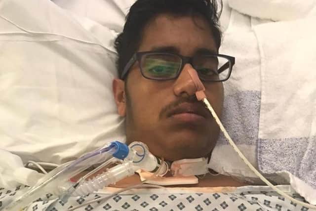 University of Portsmouth student Ben de Souza in Queen Alexandra Hospital after he fell ill with meningococcal septicaemia (MenB) which he mistook for a hangover