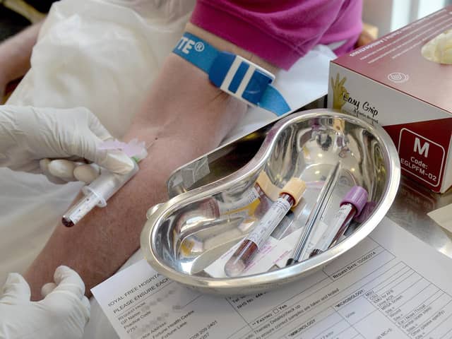 A shortage of blood tubes has put doctors and patients in a "terrible, unenviable position", with GPs facing "difficult choices" about who gets blood tests, the British Medical Association has warned. Issue date: Saturday August 28, 2021.