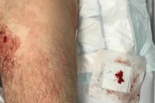 A 23-year-old man was shot in the left leg at a house in Hudson Road, Somers Town in Portsmouth, on February 3 in 2019. He has since been told the investigation has been filed.