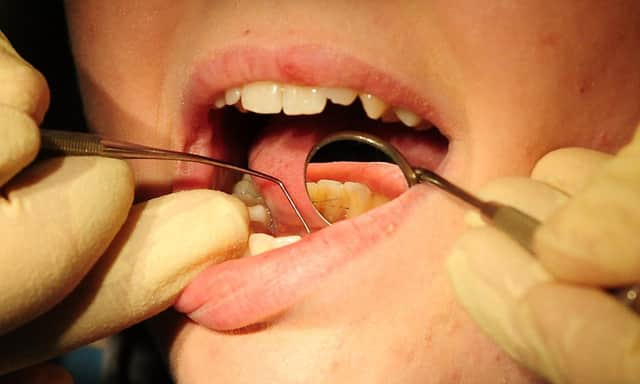 Fears remain that Paulsgrove and Portsea could be left without NHS dentists. Picture: PA
