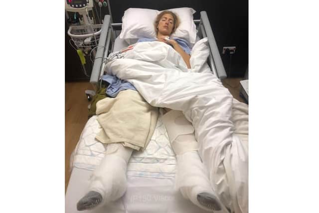 Vanessa Ruck after the accident