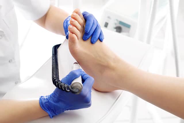 Podologist develops feet with a milling machine. Shutterstock