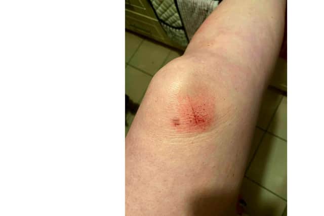 Images of Lucie Wakely, 30, after she was assaulted by her former partner Zac Slaven on Christmas Day 2019 at her home. Picture: Lucie Wakely