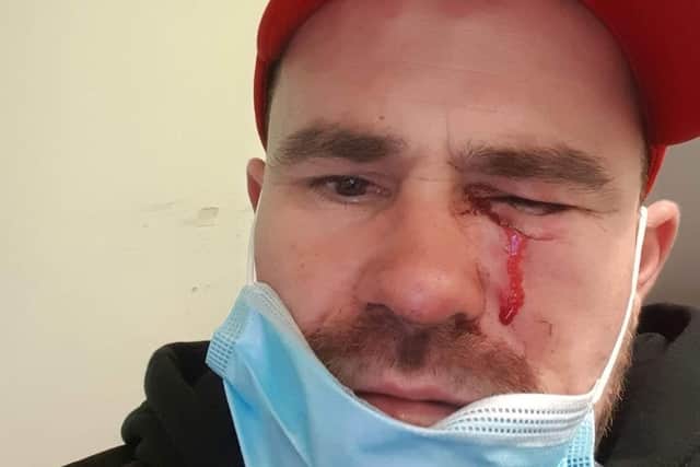 Catalin who was attacked with a knuckle duster at John Jacques pub in Fratton on April 18.