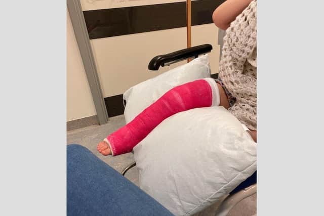 Gracie-May's broken ankle after the collision. Picture: Heidi Reeve