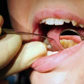 Portsmouth has the seventh lowest number of NHS dentists per 100,000 in the country, at 42.