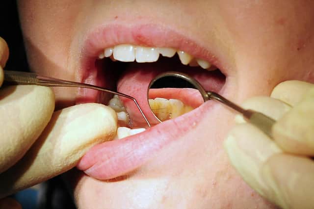 Portsmouth has the seventh lowest number of NHS dentists per 100,000 in the country, at 42.