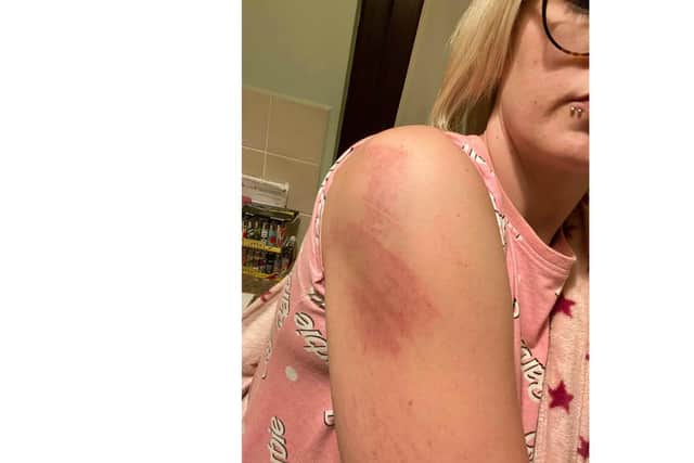 Images of Lucie Wakely, 30, after she was assaulted by her former partner Zac Slaven on Christmas Day 2019 at her home. Picture: Lucie Wakely