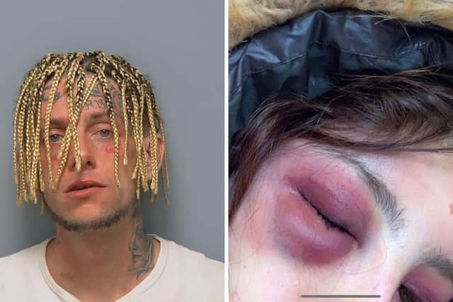 Jake Gurr  of Portsmouth has been jailed for 150 months - 12.5 years - for assaulting Anisa Hutchinson and other offences. Jake Gurr picture: Hampshire Constabulary. Injury picture submitted by Anisa.