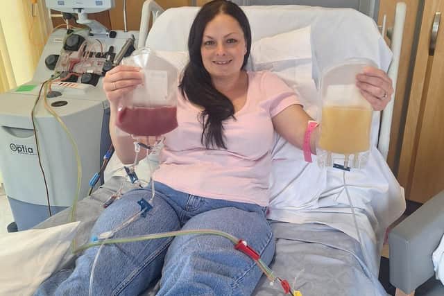 The end result of the apheresis procedure.  Eight billion stem cells to be transplanted into my 'genetic twin'. My lovely plasma ('liquid gold') containing immunoglobulins which could be used in medication treating various autoimmune illnesses and albumin (protein) used to treat burn/scalds victims, sepsis, liver and kidney dysfunction.