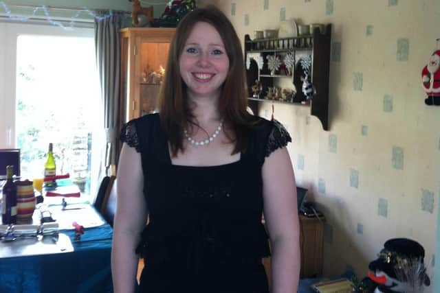 Andrea Cook from Fareham, who has tuberous breast syndrome
