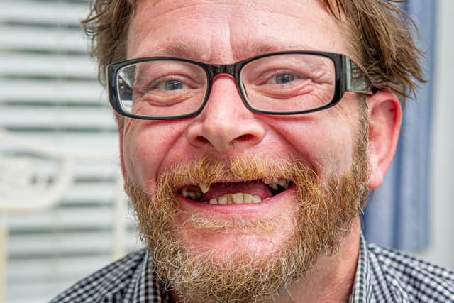 Dad-of-three Chris Savage, a labourer on Universal Credit after work dried up in the pandemic, removed two of his own teeth with a mole grip as he couldn't find a dentist who would take him on as an NHS patient and couldn't afford the £200 fee to go privatePictured: Chris Savage at his home in Milton, Portsmouth on 12 October 2020.Picture: Habibur Rahman