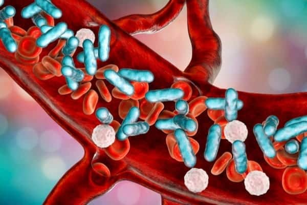 Sepsis is a serious condition that can be fatal if it isn’t spotted and treated quickly (Photo: Shutterstock)