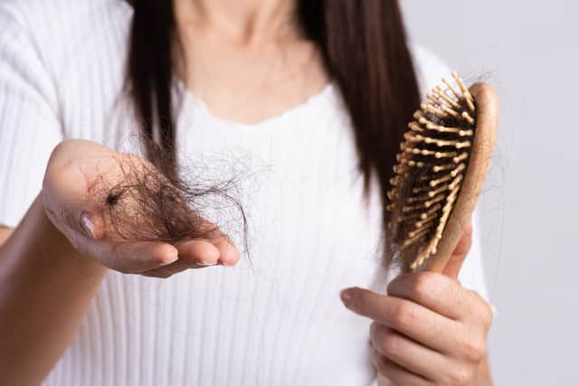 Many coronavirus sufferers have reported experiencing hair loss (Photo: Shutterstock)