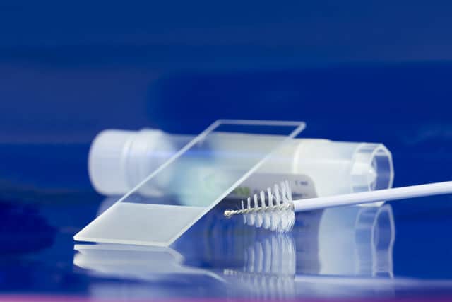 The kits will be sent to women between 25 and 64 years old who are 15 months overdue for a check (Photo: Shutterstock)