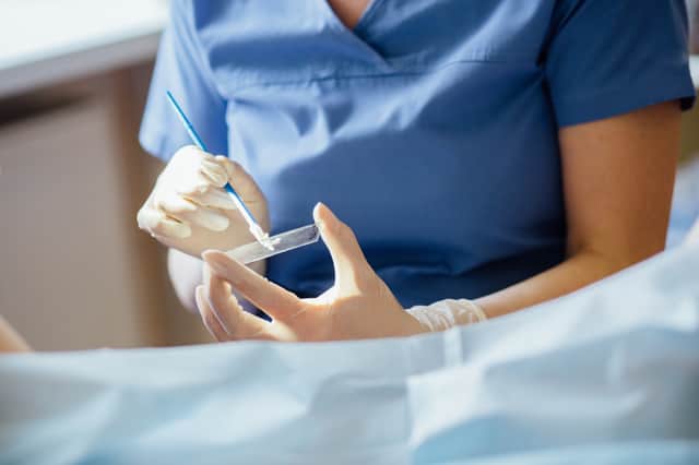 The screening involves taking a sample of cells from the cervix using a soft brush (Photo: Shuhtterstock)