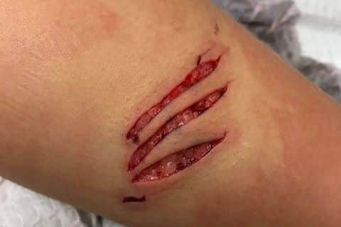 The gashes left on Lilly's leg after the incident