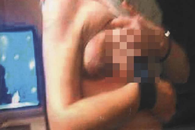 She suffered a haematoma - a swelling of clotted blood - after the accident