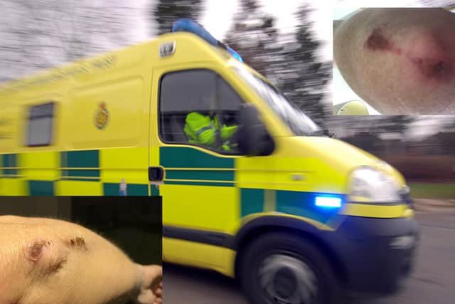 Photos of injuries to emergency care assistant Karen Rowland who was attacked by patient Keith Winning in Waterlooville. He has now been jailed.