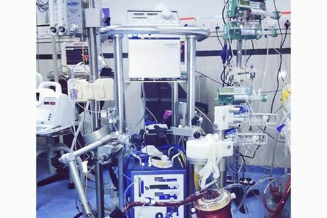 The ECMO machine which saved Laura's life.