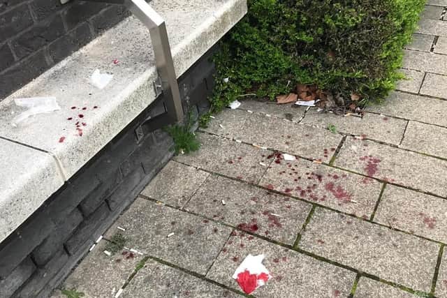 Blood at the scene of a stabbing in Ravelin Park after an argument spilled out of the University of Portsmouth library in Cambridge Road in Portsmouth into the park on March 21. Picture: Sarah Standing