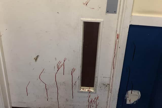 Several doors had blood splashed all over them after a 28-year-old was stabbed in the arm.