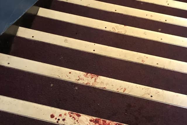 Residents said they had to avoid blooded areas, including this stairwell.
