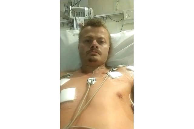 Nathan Birch in hospital after being stabbed 17 times by Ashley Luff in Southampton Road, Park Gate, on August 19, 2018. Picture: Nathan Birch