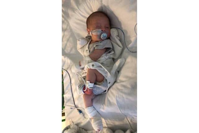 Aimee Byron's baby Jamie who almost died after he was unable to keep food down due to a digestive complication that required delicate surgery. Pciture: SWNS