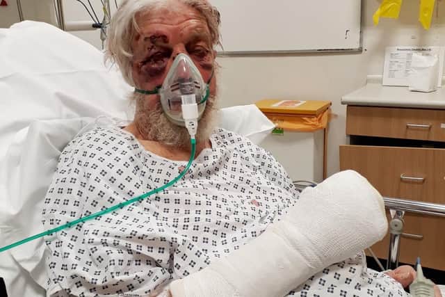 The victim was pushed in the back and fell into a wall and suffered 'horrific' injuries. Picture: Metropolitan Police/PA Wire